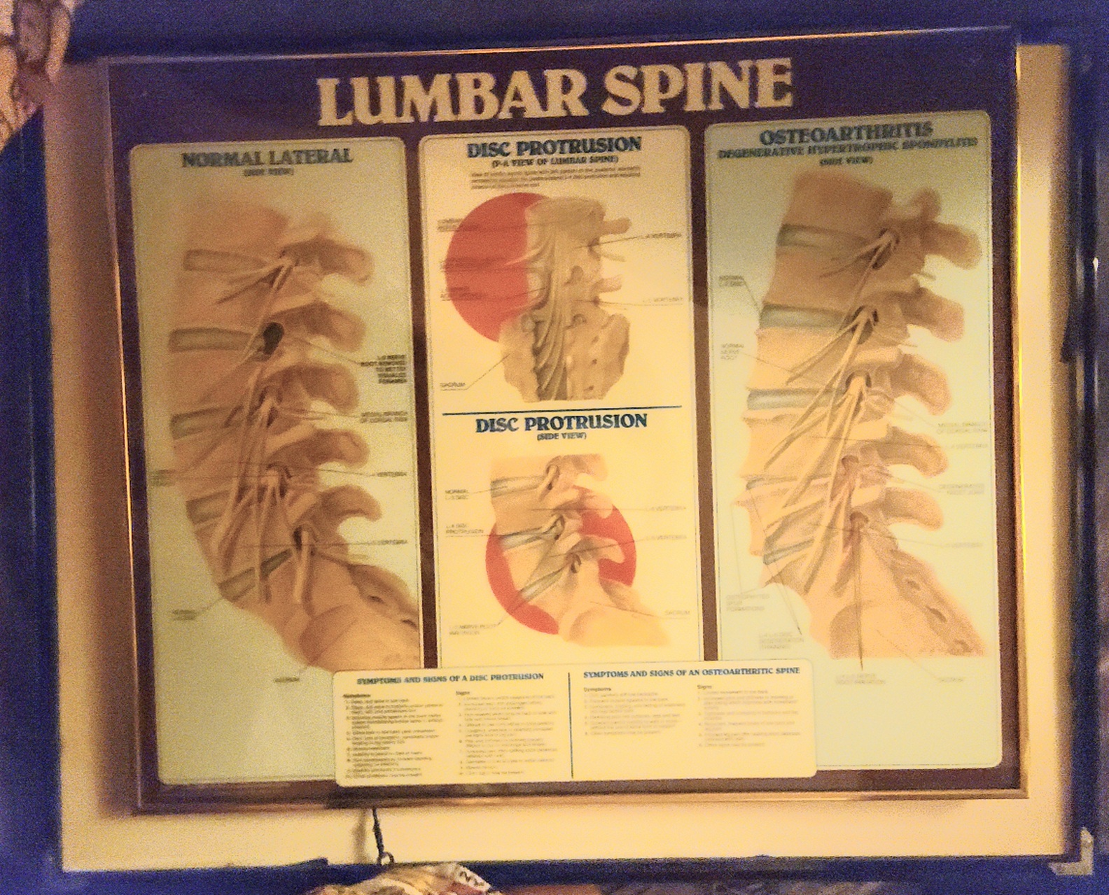 25×21 inch Framed picture