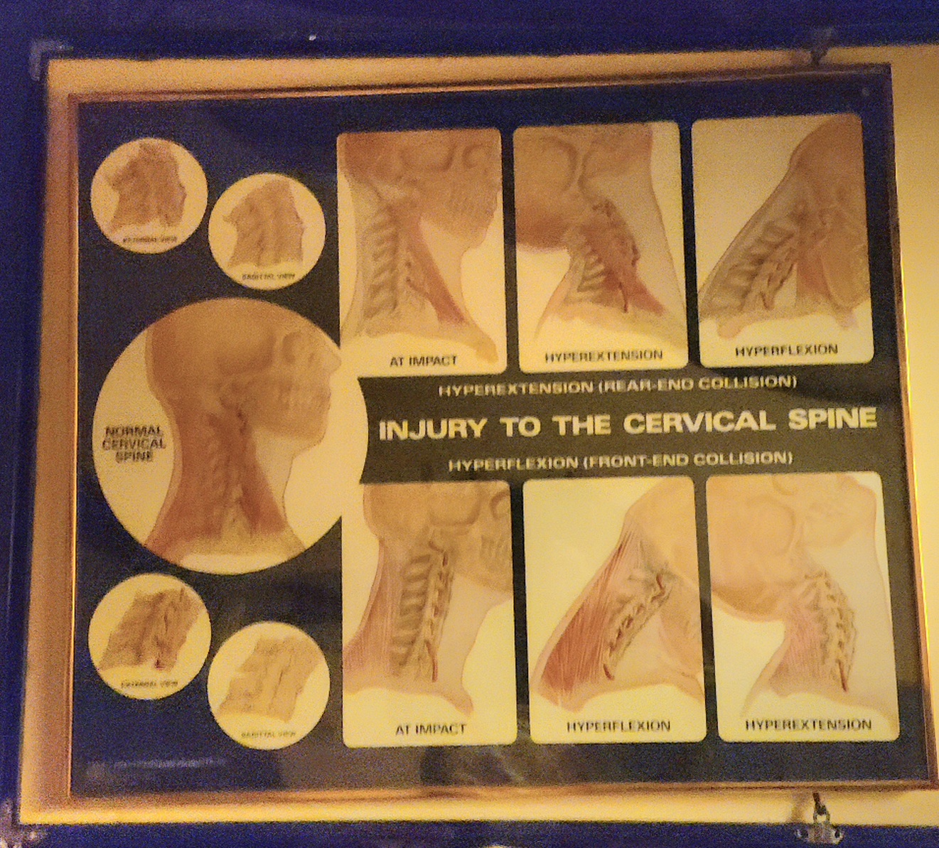 25×21 inch Framed picture