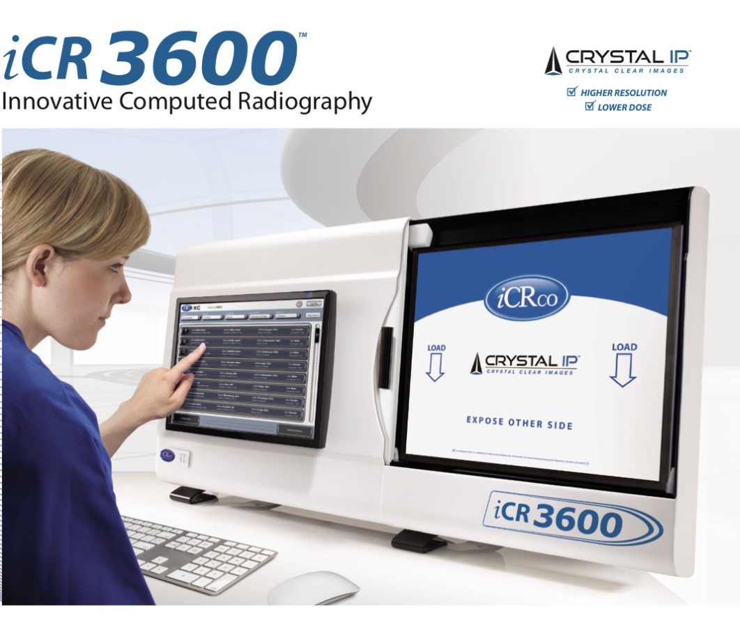 INSTANT Digital X-ray conversion